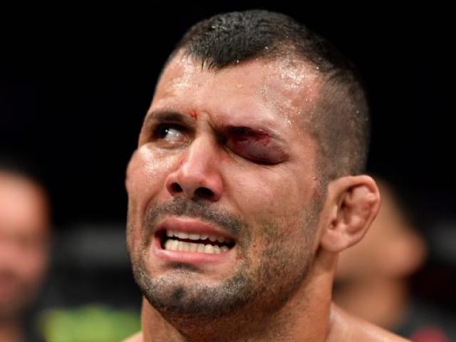 Đáng sợ UFC: Mắt sưng to như trái bóng vẫn siết đối thủ ”tắt thở”