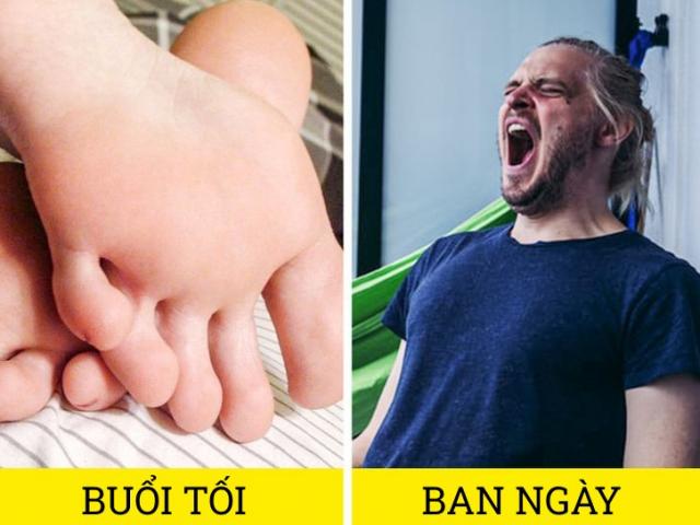 Thói quen cọ xát bàn chân không vô hại như nhiều người nghĩ, hãy cẩn thận với nó