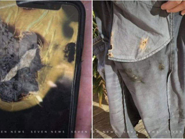 iPhone X phát nổ trong túi quần, gây bỏng cho người dùng
