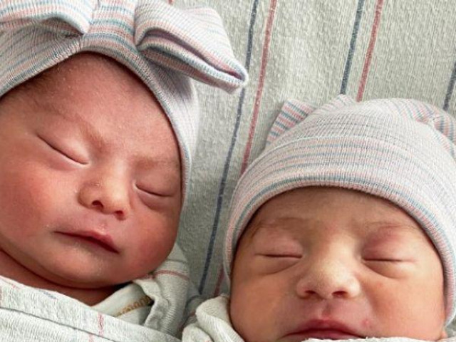 Lạ lùng cặp song sinh chào đời vào 2 năm khác nhau
