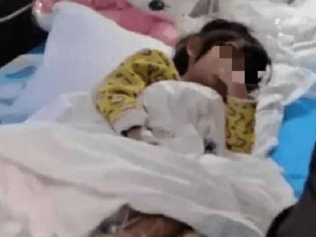 Bé gái 4 tuổi bị ”mẹ kế” dội nước sôi, bạo hành đến mức suýt phải cắt cụt hai chân