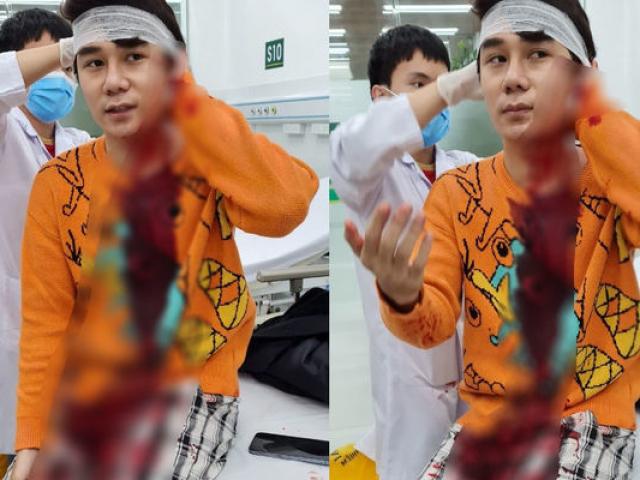 Khởi tố vụ diễn viên phim “Thương ngày nắng về” bị tấn công trên phố Hà Nội