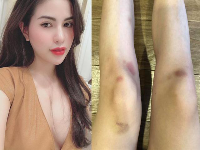 Vợ hot girl của Việt Anh gây bàn tán vì hình ảnh ”bạo lực gia đình”