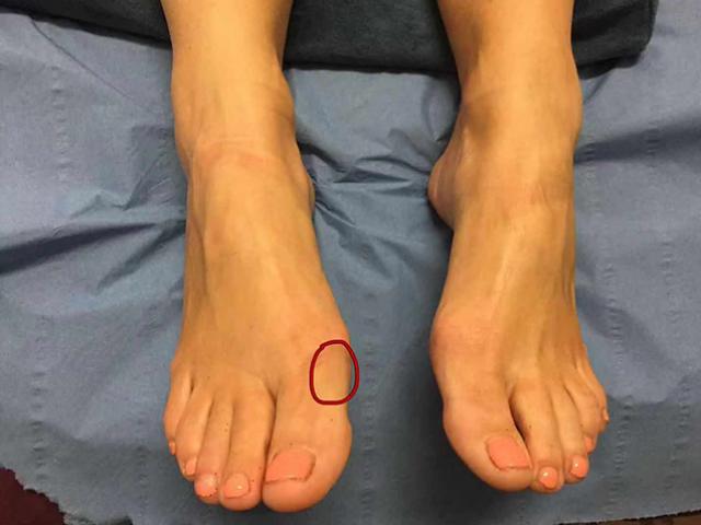 Bàn chân xuất hiện 8 điểm này tuyệt đối không được lơ là vì có thể là dấu hiệu bệnh nguy hiểm
