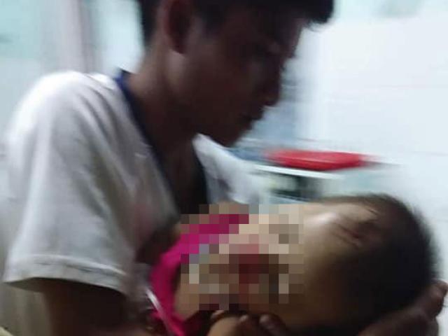 Hy hữu chuyện cháu bé 2 tuổi ở Quảng Nam gặp nạn ”trên trời rơi xuống”
