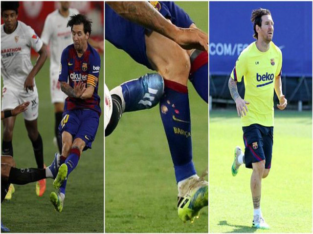 Lộ lý do Messi nổi giận, đẩy ngã đối thủ: Đau lòng vết xước dài trên chân