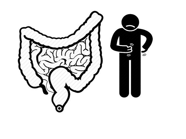 Nguy hiểm hơn cả thuốc lá và rượu, đây là nguyên nhân nguy hiểm nhất gây ung thư trực tràng