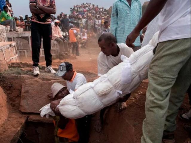 CH Congo: Dịch bệnh khiến bệnh nhân ho ra máu, 15 người nhiễm 11 người tử vong