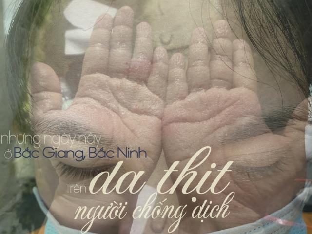 Những ngày này ở Bắc Ninh, Bắc Giang trên da thịt người chống dịch