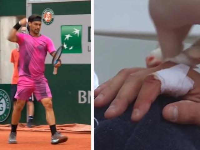 Cú sốc Roland Garros: Tay vợt thua trận vì tự làm đau bàn tay