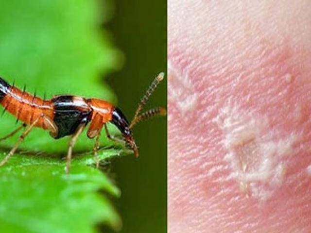 ”Mùa” kiến ba khoang, làm gì để phòng tránh loài côn trùng này?