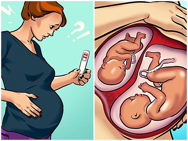 Siêu thai: hiện tượng thụ thai trong khi mang bầu khiến thế giới kinh ngạc