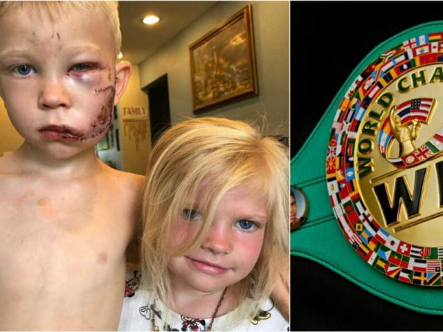 Cậu bé 6 tuổi đánh nhau với chó cứu em, bị khâu 90 mũi: Vinh danh người hùng