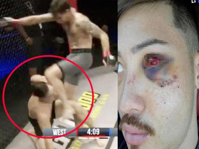 Góc tối MMA: Võ sĩ nhận “đòn bẩn” chấn thương hãi hùng “mắt rồng đỏ”
