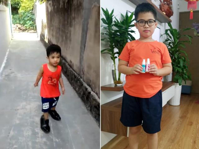 Từng trầm cảm vì con suy dinh dưỡng, thấp còi, mẹ 8X giúp con “lội ngược dòng ngoạn mục”, tăng chiều cao vượt trội
