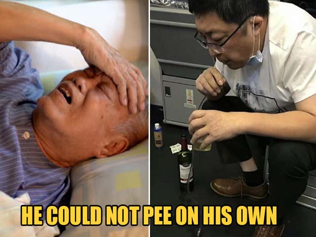 Bác sĩ dùng miệng hút 800ml nước tiểu cứu bệnh nhân không bị vỡ bàng quang