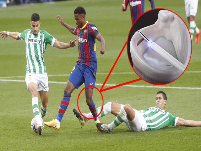 SAO Barca 400 triệu euro chấn thương nặng: Phải nghỉ vài tháng, Messi nặng gánh