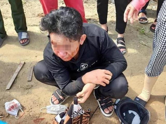 Quảng Bình: Trên đường đi học về, học sinh bị đánh bất tỉnh
