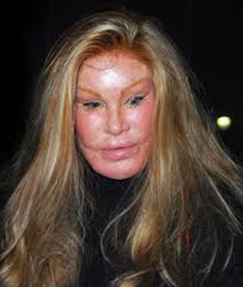 Giải thích cho hành động kì quặc của mình bà Jocelyn Wildensteinlà cho biết, chồng bà rất yêu thích mèo. Bà hi vọng sau khi phẫu thuật xong sẽ được chồng yêu hơn. Tuy nhiên kết quả sau khi phẫu thuật lại không giúp bà Jocelyn Wildenstein đạt được nguyện vọng.