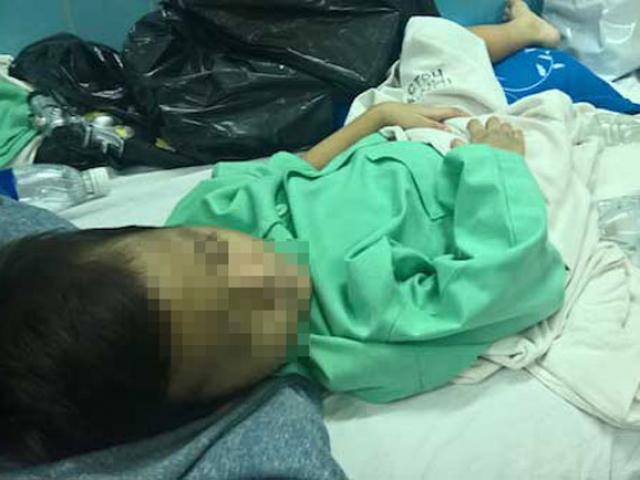 Tin tức trong ngày - Bé trai bị mẹ đẻ, bố dượng đánh gãy xương đùi