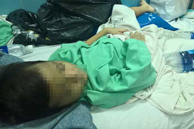 Bé trai bị mẹ đẻ, bố dượng đánh gãy xương đùi - 1