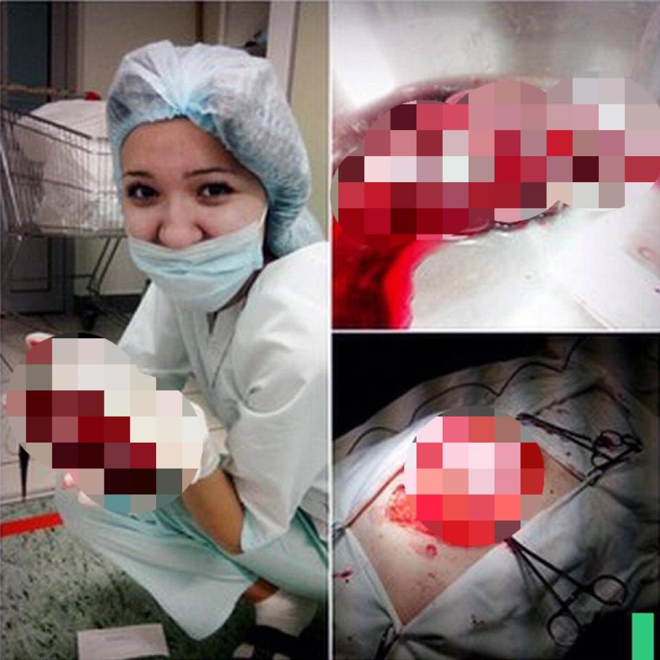 Nữ y tá Nga chơi đùa với nội tạng bệnh nhân gây phẫn nộ - 2