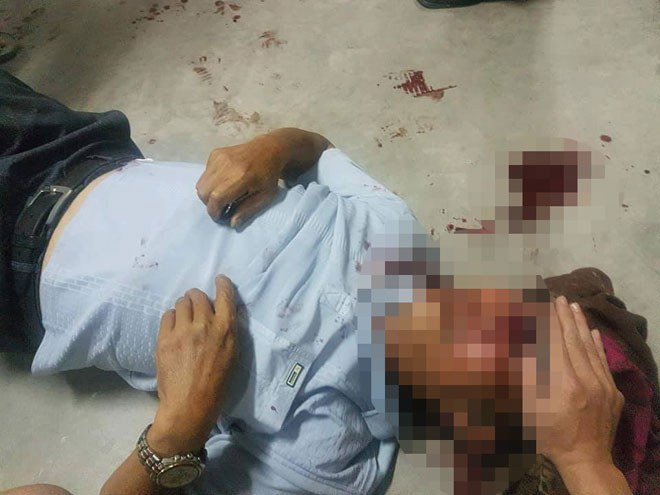 Cụ ông bị bảo vệ chung cư đánh gãy sống mũi - 1