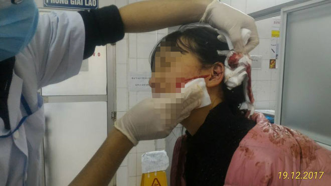 Nóng 24h qua: Bố chồng chém chết con dâu trong lễ cúng 49 ngày con trai - 4