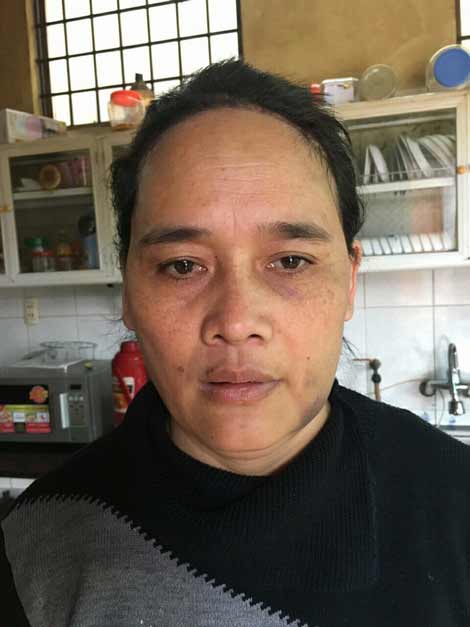 Nỗi đau tận cùng sau những cơn say - 3