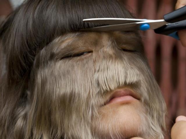 Sức khỏe đời sống - "Người sói" ở Thái Lan lộ mặt thật, lấy được chồng