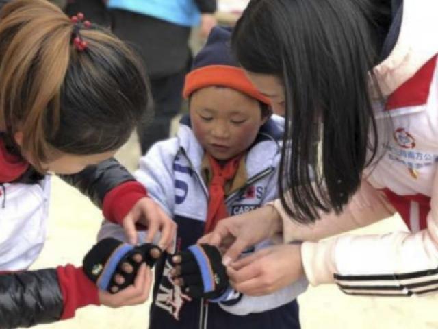 Thế giới - Cái kết hạnh phúc của cậu bé TQ bị đóng băng toàn bộ tóc