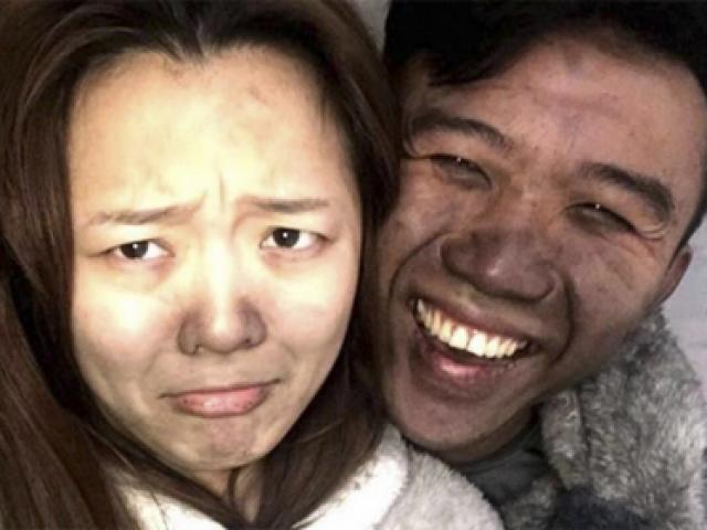 Bạn trẻ - Cuộc sống - Cặp vợ chồng vô tư "tự sướng" dù nhà vừa bị cháy