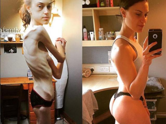 Bí quyết làm đẹp - Khó tin với sự lột xác thần kỳ của "bộ xương khô"