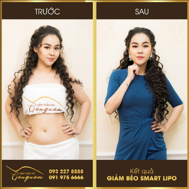 “Đặt lên bàn cân” những phương pháp giảm béo được quan tâm nhiều nhất - 3