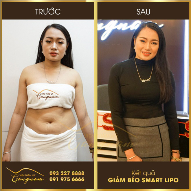 “Đặt lên bàn cân” những phương pháp giảm béo được quan tâm nhiều nhất - 4