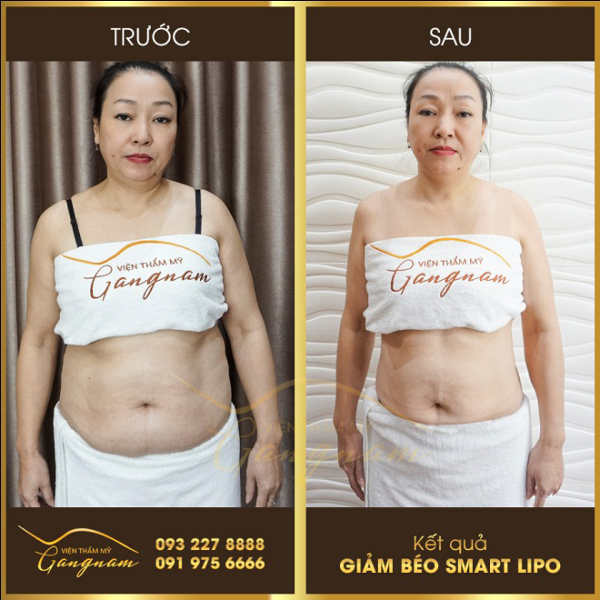 “Đặt lên bàn cân” những phương pháp giảm béo được quan tâm nhiều nhất - 5