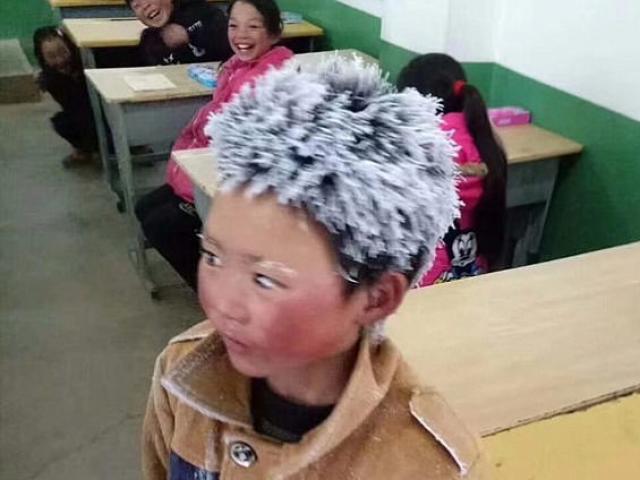 Thế giới - Cậu bé TQ đầu đóng băng chỉ nhận được 1/62 tiền quyên góp