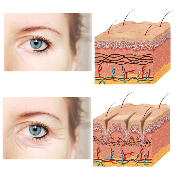 Chị em mê mẩn công nghệ giúp tạo cằm Vline, da căng mịn không đụng dao kéo - 3