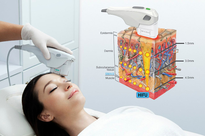 Chị em mê mẩn công nghệ giúp tạo cằm Vline, da căng mịn không đụng dao kéo - 5