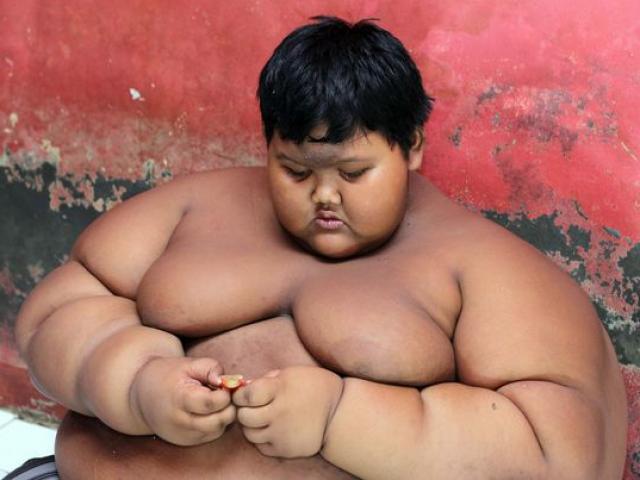Cậu bé béo nhất thế giới nặng gần 2 tạ ”đổi đời” vì giảm cân