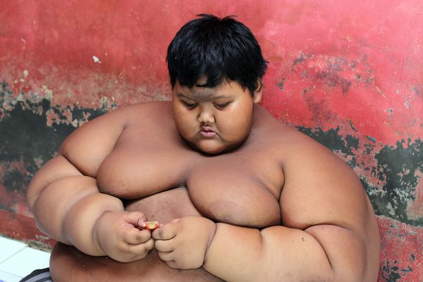 Cậu bé béo nhất thế giới nặng gần 2 tạ &#34;đổi đời&#34; vì giảm cân - 1