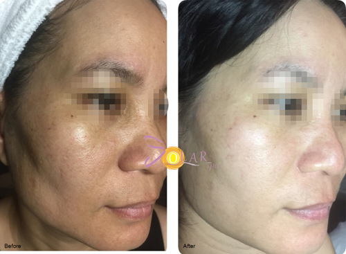 Công nghệ siêu trắng Super Nano White giúp da trắng hồng đón Tết - 1