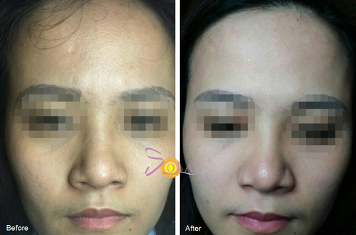 Công nghệ siêu trắng Super Nano White giúp da trắng hồng đón Tết - 2