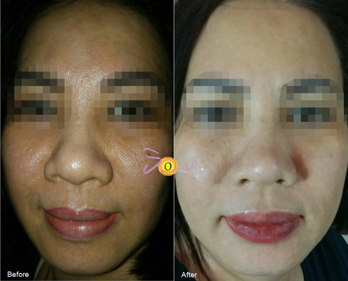 Công nghệ siêu trắng Super Nano White giúp da trắng hồng đón Tết - 3