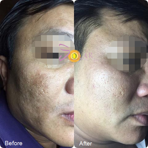 Công nghệ siêu trắng Super Nano White giúp da trắng hồng đón Tết - 4