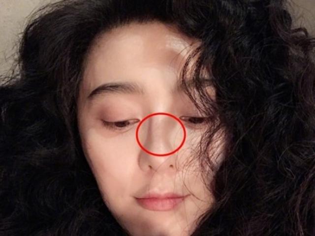 Phim - Phạm Băng Băng bị nghi gãy mũi do phẫu thuật thẩm mỹ