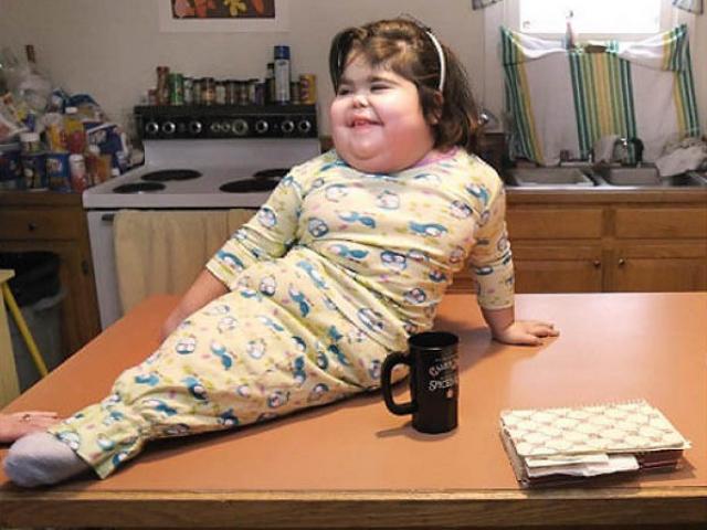 Sức khỏe đời sống - Bi kịch hội chứng "nàng tiên cá" và những bí ẩn chưa thể giải đáp