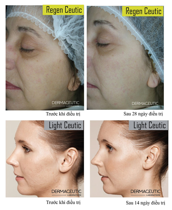 Bí quyết phục hồi làn da trắng sáng, đánh bật nếp nhăn - 2