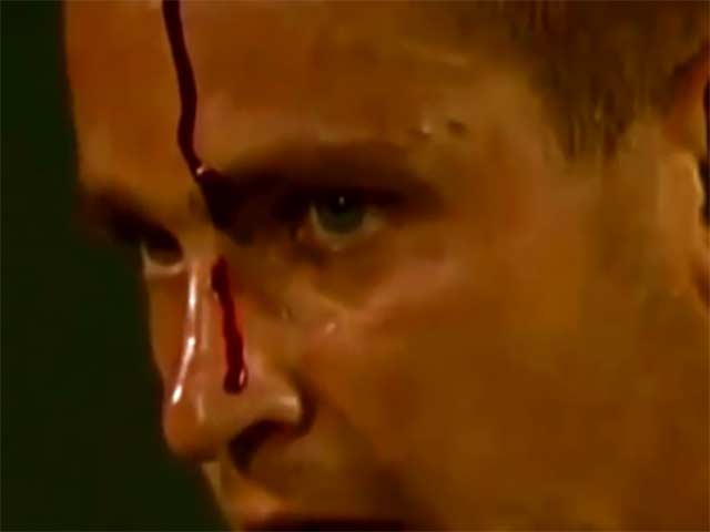 Thể thao - Điên rồ tennis: Thua điểm, cầm vợt tự đập đầu chảy máu