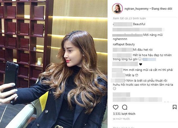 Huyền My vừa phẫu thuật thẩm mỹ vì gương mặt bất ngờ khác lạ? - 2